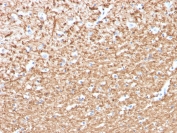 IHC staining of FFPE human brain with Myelin Basic Protein antibody (clone MBP/4276). HIER: boil tissue sections in pH 9 10mM Tris with 1mM EDTA for 20 min and allow to cool before testing.