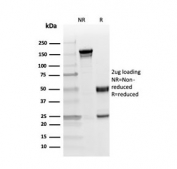 SDS-PAGE analysis of purified, BSA-free Myelin Basic Protein antibody (clone MBP/4276) as confirmation of integrity and purity.
