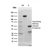 SDS-PAGE analysis of purified, BSA-free Adiponectin antibody (clone ADPN/4256) as confirmation of integrity and purity.