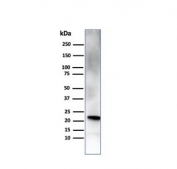 Western blot testing of human pancreas tissue with RBP4 antibody. Predicted molecular weight ~23 kDa.