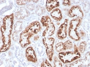 IHC staining of FFPE human kidney with RBP4 antibody. HIER: boil tissue sections in pH 9 10mM Tris with 1mM EDTA for 20 min and allow to cool before testing.