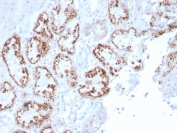 IHC staining of FFPE human kidney with RBP4 antibody. HIER: boil tissue sections in pH 9 10mM Tris with 1mM EDTA for 20 min and allow to cool before testing.