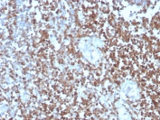 IHC staining of FFPE human tonsil with CD27 antibody (clone LPFS2/4177). HIER: boil tissue sections in pH 9 10mM Tris with 1mM EDTA for 20 min and allow to cool before testing.