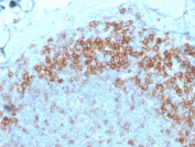 IHC staining of FFPE human tonsil with CD27 antibody (clone LPFS2/4177). HIER: boil tissue sections in pH 9 10mM Tris with 1mM EDTA for 20 min and allow to cool before testing.
