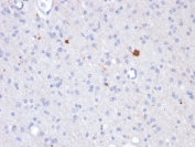 IHC staining of FFPE human brain with Beta Amyloid antibody (clone APP/3343). HIER: boil tissue sections in pH 9 10mM Tris with 1mM EDTA for 20 min and allow to cool before testing.