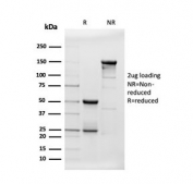 SDS-PAGE analysis of purified, BSA-free Beta Amyloid antibody (clone APP/3343) as confirmation of integrity and purity.