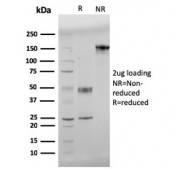 SDS-PAGE analysis of purified, BSA-free Amyloid Beta antibody (clone APP/3345) as confirmation of integrity and purity.