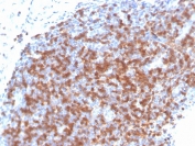 IHC staining of FFPE human tonsil with recombinant ZAP70 antibody. HIER: boil tissue sections in pH 9 10mM Tris with 1mM EDTA for 20 min and allow to cool before testing.
