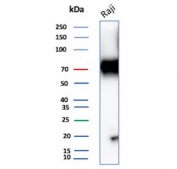 Western blot testing of human Raji cell lysate with CD86 antibody (clone C86/3711). Expected molecular weight: 38-70 kDa depending on glycosylation level.