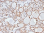 Immunofluorescent staining of PFA-fixed human HeLa cells using UBR2 antibody (green, clone PCRP-UBR2-1D12) and phalloidin (red).