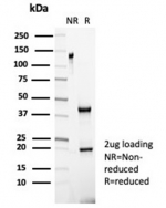 SDS-PAGE analysis of purified, BSA-free Negative control antibody (IGG1/453) as confirmation of integrity and purity.