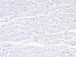 IHC staining of FFPE human heart tissue with Negative control antibody (clone IGG1/453). HIER: boil tissue sections in pH 9 10mM Tris with 1mM EDTA for 20 min and allow to cool before testing.