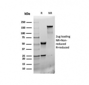 SDS-PAGE analysis of purified, BSA-free CD31 antibody (rPECAM1/6439) as confirmation of integrity and purity.
