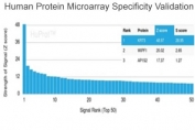Analysis of HuProt(TM) microarray containing more than 19,000 full-length human proteins using CK5 antibody (clone KRT5/6466). These results demonstrate the foremost specificity of the KRT5/6466 mAb. Z- and S- score: The Z-score represents the strength of a signal that an antibody (in combination with a fluorescently-tagged anti-IgG secondary Ab) produces when binding to a particular protein on the HuProt(TM) array. Z-scores are described in units of standard deviations (SD's) above the mean value of all signals generated on that array. If the targets on the HuProt(TM) are arranged in descending order of the Z-score, the S-score is the difference (also in units of SD's) between the Z-scores. The S-score therefore represents the relative target specificity of an Ab to its intended target.