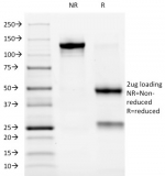 SDS-PAGE analysis of purified, BSA-free Anaplastic Lymphoma Kinase antibody (ALK/1032) as confirmation of integrity and purity.