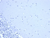 Negative control: IHC staining of FFPE human brain tissue using CD44 antibody (clone rHCAM/6449) at 2ug/ml in PBS for 30min RT. HIER: boil tissue sections in pH 9 10mM Tris with 1mM EDTA for 20 min and allow to cool before testing.