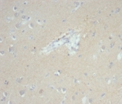 IHC staining of FFPE human brain tissue with recombinant EpCAM antibody (clone EGP40/7035R). HIER: boil tissue sections in pH 9 10mM Tris with 1mM EDTA for 20 min and allow to cool before testing.