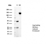 SDS-PAGE analysis of purified, BSA-free CD36 antibody (clone CD36/7217) as confirmation of integrity and purity.