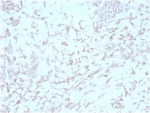 IHC staining of FFPE human liver tissue with Kindlin 2 antibody (clone 3A3). HIER: boil tissue sections in pH 9 10mM Tris with 1mM EDTA for 20 min and allow to cool before testing.
