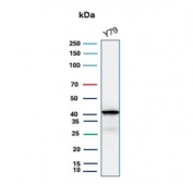 Western blot testing of human Y79 cell lysate using Glutamine Synthetase antibody (clone GLUL/6600). Predicted molecular weight ~42 kDa.