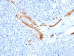 IHC staining of FFPE human tonsil tissue with KRT16 antibody (clone SPM264). HIER: boil tissue sections in pH 9 10mM Tris with 1mM EDTA for 20 min and allow to cool before testing.