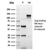 SDS-PAGE analysis of purified, BSA-free recombinant Cytokeratin 20 antibody (clone rKRT20/6536) as confirmation of integrity and purity.