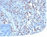 IHC staining of FFPE human lymph node tissue with recombinant LEF1 antibody (clone rLEF1/6906) at 2ug/ml in PBS for 30min RT. Strong nuclear staining of non-germinal center cells is observed. Negative control inset: PBS instead of primary antibody to control for secondary binding. HIER: boil tissue sections in pH 9 10mM Tris with 1mM EDTA for 20 min and allow to cool before testing.