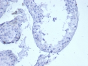 Negative control: IHC staining of FFPE human brain tissue using recombinant Keratin 5 antibody (clone KRT5/6399R) at 2ug/ml in PBS for 30min RT. HIER: boil tissue sections in pH 9 10mM Tris with 1mM EDTA for 20 min and allow to cool before testing.