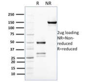 SDS-PAGE analysis of purified, BSA-free Bcl-W antibody (clone PCRP-BCL2L2-1A4) as confirmation of integrity and purity.