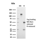 SDS-PAGE analysis of purified, BSA-free Cytokeratin 6 antibody (clone SPM269) as confirmation of integrity and purity.