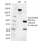 SDS-PAGE analysis of purified, BSA-free Cytokeratin 8 antibody (clone SPM538) as confirmation of integrity and purity.