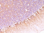 IHC: Formalin-fixed, paraffin-embedded human cerebellum stained with anti-Neurofilament antibody (SPM563).