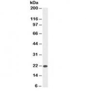 Western blot testing of HeLa cell lysate with anti-Bax antibody (clone SPM336). Observed molecular weight ~21 kDa.