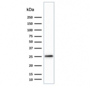 Western blot testing of human brain lysate with anti-PGP9.5 antibody (clone SPM574). Predicted molecular weight ~25 kDa.