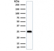 Western blot testing of human brain lysate with anti-UchL1 antibody (clone SPM575). Predicted molecular weight ~25 kDa.