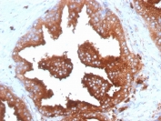 IHC: Formalin-fixed, paraffin-embedded human prostate tissue stained with anti-CD63 antibody (clone SPM524) and DAB chromogen. 