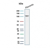 Western blot testing of human placental tissue lysate with recombinant CDH1 antibody (clone CDH1/7034R). Expected molecular weight: 135 kDa (precursor), 80-120 kDa (mature, depending on glycosylation level).