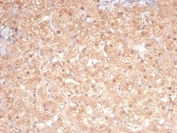 IHC staining of FFPE cat liver tissue with PRKCI antibody (clone PRKCI/4911). HIER: boil tissue sections in pH 9 10mM Tris with 1mM EDTA for 20 min and allow to cool before testing.