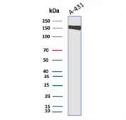 Western blot testing of human A431 cell lysate with EGF Receptor antibody. Expected molecular weight: 134-180 kDa depending on glycosylation level.