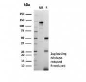 SDS-PAGE analysis of purified, BSA-free EGF Receptor antibody (clone EGFR/4575) as confirmation of integrity and purity.