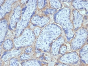 IHC staining of FFPE human placental tissue with recombinant EGFR antibody (clone EGFR/6390R). HIER: boil tissue sections in pH 9 10mM Tris with 1mM EDTA for 20 min and allow to cool before testing.