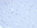 Negative control: IHC staining of FFPE human brain tissue with recombinant Ki67 antibody (clone rMKI67/6615) at 2ug/ml in PBS for 30min RT. HIER: boil tissue sections in pH 9 10mM Tris with 1mM EDTA for 20 min and allow to cool before testing.