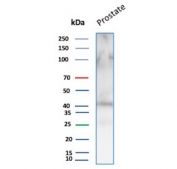 Western blot testing of human prostate tissue lysate with recombinant CD47 antibody (clone rCD47/6589). Expected molecular weight: 35~60 kDa depending on glycosylation level.