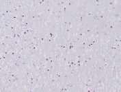 IHC staining of FFPE human cerebellum tissue with recombinant OLIG2 antibody (clone OLIG2/6695R). HIER: boil tissue sections in pH 9 10mM Tris with 1mM EDTA for 20 min and allow to cool before testing.
