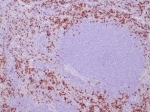 IHC staining of FFPE human spleen tissue with recombinant TIA-1 antibody (clone TIA/1352R). HIER: boil tissue sections in pH 9 10mM Tris with 1mM EDTA for 20 min and allow to cool before testing.