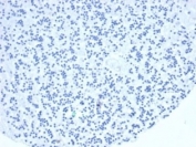 Negative control: IHC staining of FFPE human brain tissue with recombinant TIA-1 antibody (clone TIA1/1352R) at 2ug/ml in PBS for 30min RT. HIER: boil tissue sections in pH 9 10mM Tris with 1mM EDTA for 20 min and allow to cool before testing.