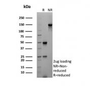 SDS-PAGE analysis of purified, BSA-free AKR1B1 antibody (clone rAKR1B1/7295) as confirmation of integrity and purity.