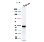 Western blot testing of human 293T cell lysate with recombinant Aldose reductase antibody (clone AKR1B1/7010R). Predicted molecular weight ~36 kDa.