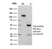 SDS-PAGE analysis of purified, BSA-free recombinant Filaggrin antibody (clone FLG/3909R) as confirmation of integrity and purity.