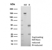 SDS-PAGE analysis of purified, BSA-free recombinant CALD1 antibody (clone rCALD1/7266) as confirmation of integrity and purity.